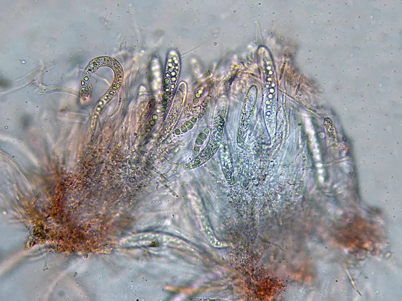 Amniculicola lignicola 9 - Himenio x 400-001